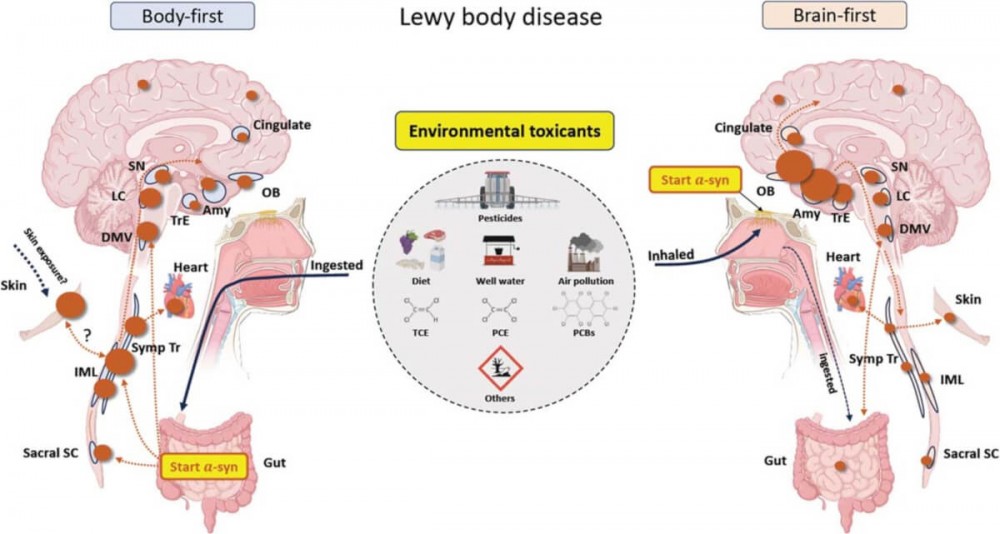 20240422_662604e0e4aa3 Environmental toxins may be triggering different types of Parkinson’s disease